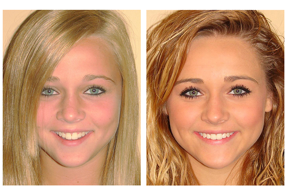 Watson Pointe Dental