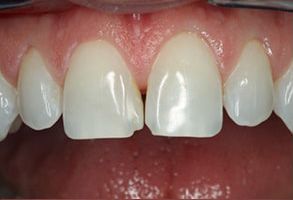 Watson Pointe Dental | Extractions, CEREC reg  and Oral Exams